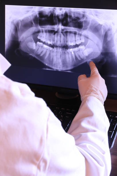 Best Knocked-Out Tooth (Avulsed Tooth) Treatment in North Charleroi, PA
