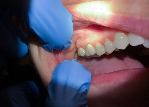 Best Emergency Cosmetic Dentistry (e.g., broken veneers) in North Charleroi, PA